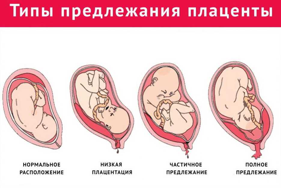 Плацента в ходе беременности: что важно знать - наблюдение беременности.  здоровье