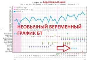 График базальной температуры - примеры и расшифровки