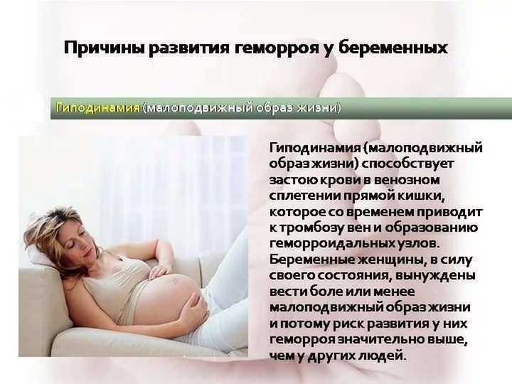 Геморрой при беременности: симптомы, чем лечить в домашних условиях