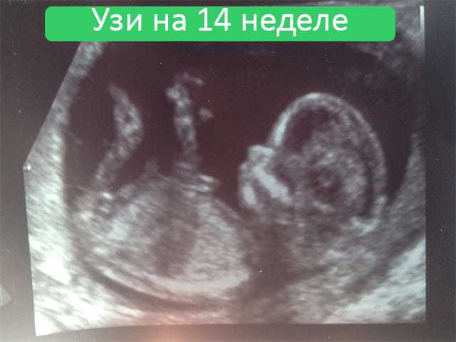 14 неделя беременности: что происходит в животе, фото плода