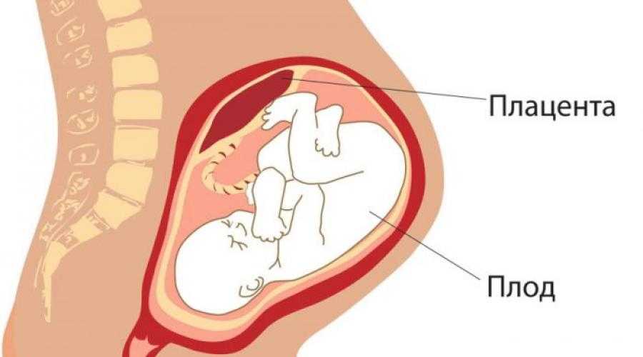 Чем опасна низкая плацентация при беременности Каковы её причины и признаки Как лечится низкая плацентация на 20 неделе Как протекают роды при этом явлении