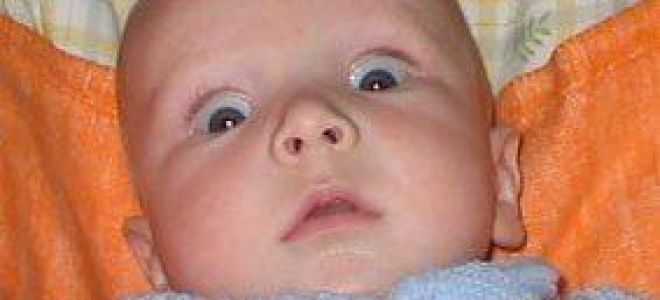 Новорожденный закатывает глаза - медицина