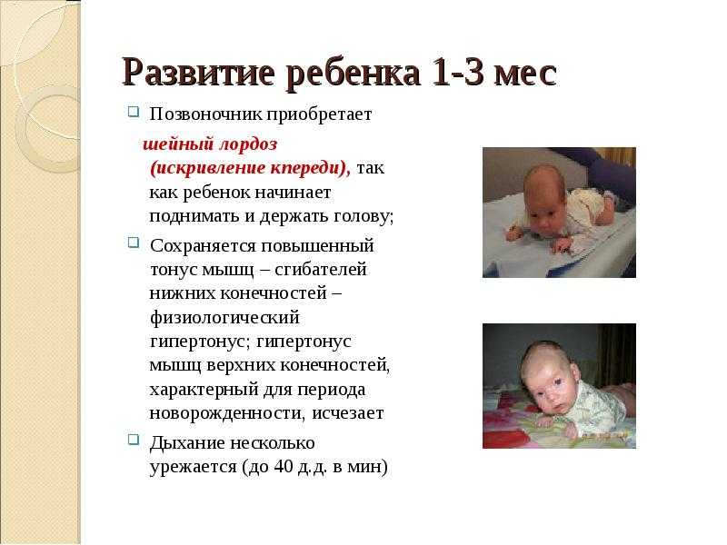 Диагностика и лечение гипертонуса у новорожденных
