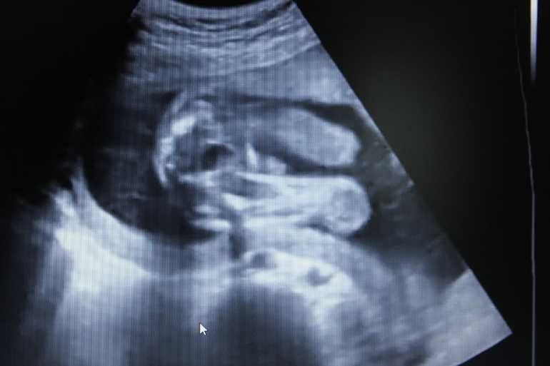 21 неделя беременности (60 фото): что происходит с малышом и мамой, сколько это месяцев, 20-21 акушерская неделя, развитие и ощущения на 19 неделе от зачатия