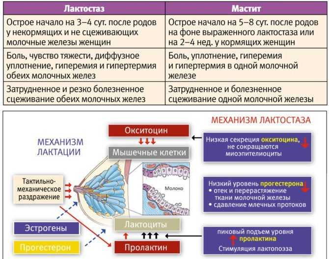 Мастит Молочной Железы Фото