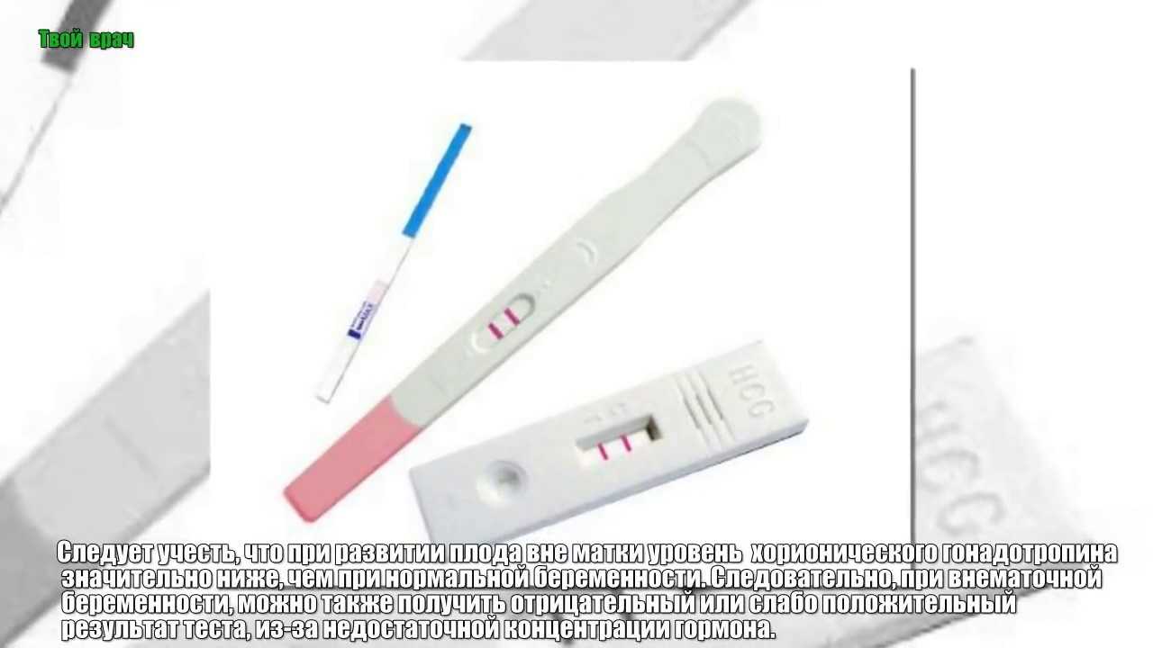 Показывает ли тест внематочную беременность до задержки и на ранних сроках