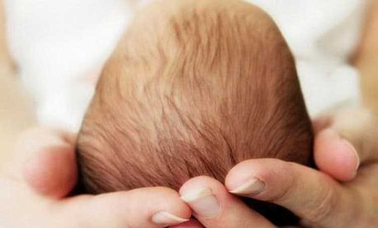 Родничок у новорожденных: когда зарастает, и что на это влияет