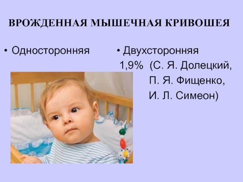 Признаки кривошеи у новорожденных (13 фото): симптомы у грудничка и ребенка в 2-3 месяца