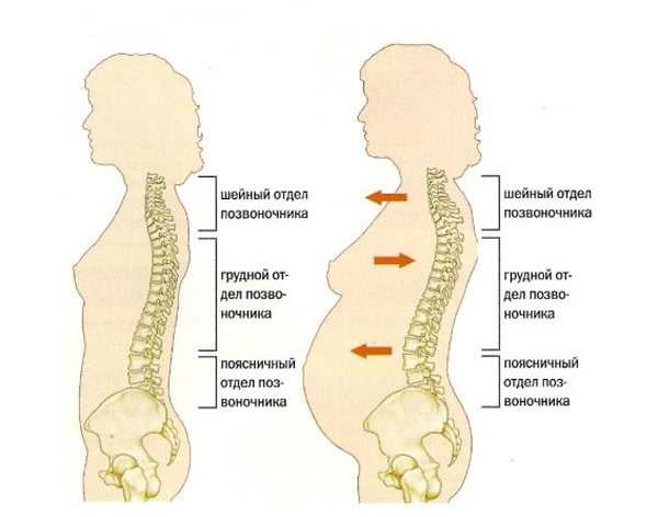 Почему болит спина при беременности и что делать?