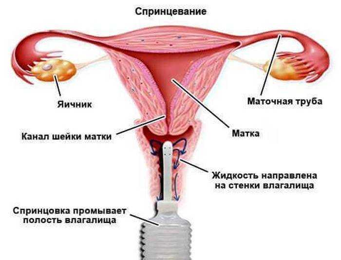 Как пить содовый раствор во время беременности