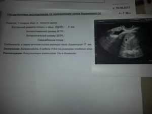 Можно ли делать флюорографию при беременности и какие последствия могут быть на разных сроках + фото, видео и отзывы