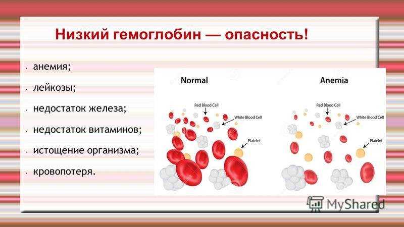 Высокий гемоглобин у беременных лечение