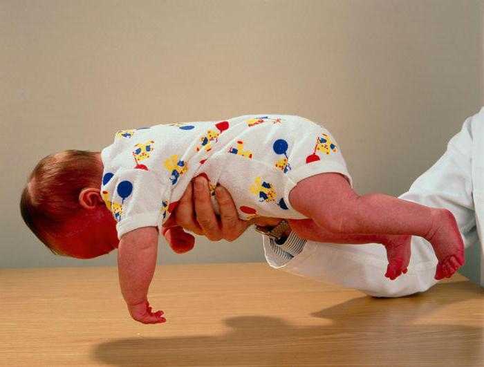 Синдром мышечной дистонии у ребенка-грудничка: детский массаж и гимнастика