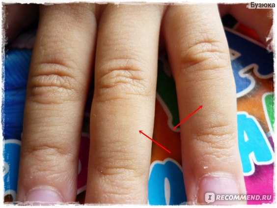 Почему дети грызут ногти ?