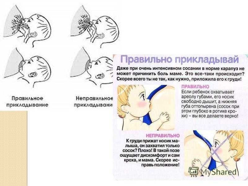 Ребенок неправильно берет грудь: способы прикладывания к груди, захват соска и расположение губ ребенка на соске