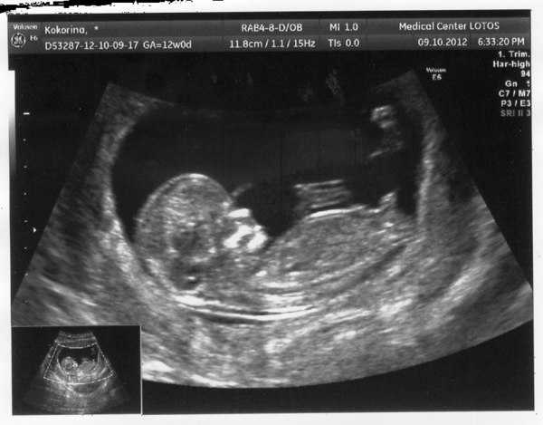 22 неделя беременности: что происходит с малышом, размер и развитие плода, шевеления ребенка и ощущения мамы, фото узи / mama66.ru