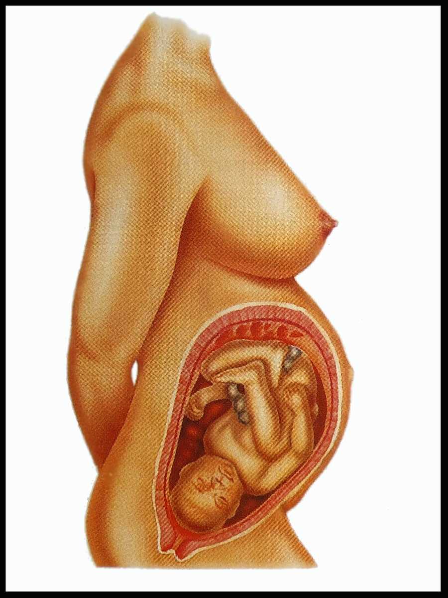 Гипертонус матки во 2 триместр при беременности