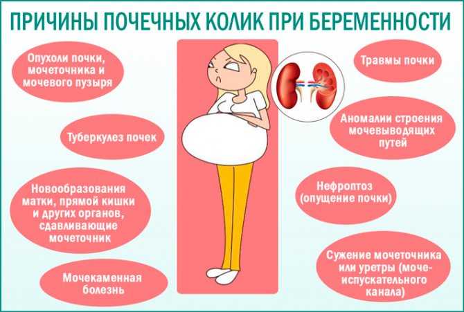 Лечение боли в ногах во время беременности
