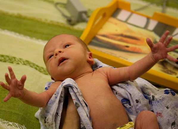 Рефлекс моро у новорожденных детей: когда проходит, спонтанный рефлекс