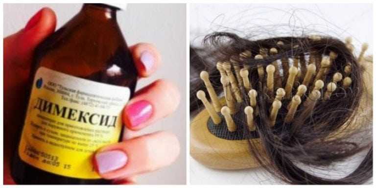 ᐈ выпадение волос у женщин: причины и методы лечения
