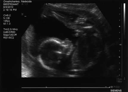 28 неделя беременности: что происходит с малышом и мамой?