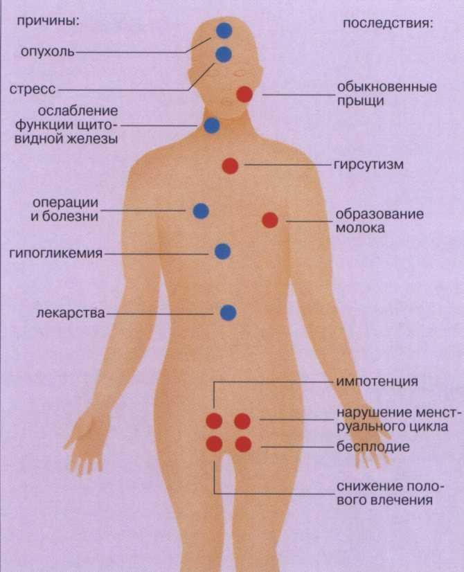 Карта прыщей на спине