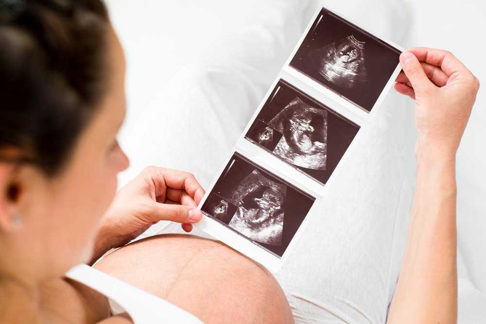 Чем уникальна 28 неделя беременности изменения в организме матери развитие малыша Обследования и осложнения в этот период полезные советы и рекомендации