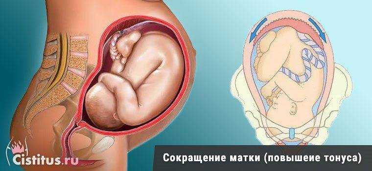 Причины и признаки тонуса матки при беременности
