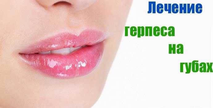 Герпес на губах - причины, симптомы и лечение герпеса :: polismed.com