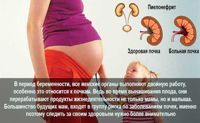 Особенности гестационного пиелонефрита при беременности