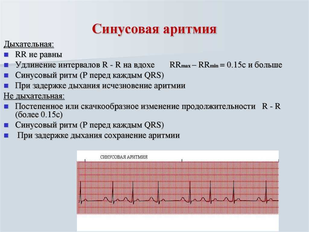Тахикардия при беременности: причины, симптомы, лечение / mama66.ru