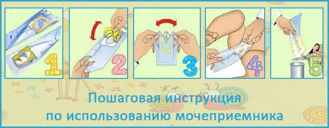 Как собрать мочу у новорожденной девочки: грудничка, как взять мочу, мочеприемник, пакет
