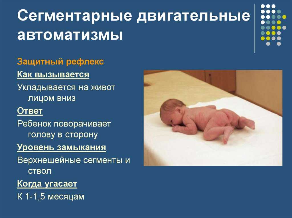 Какие бывают виды рефлексов у новорожденных и их описания