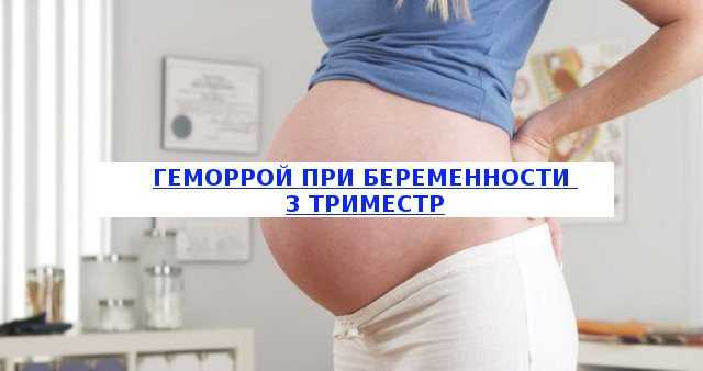 Геморрой при беременности и особенности его лечения в домашних условиях