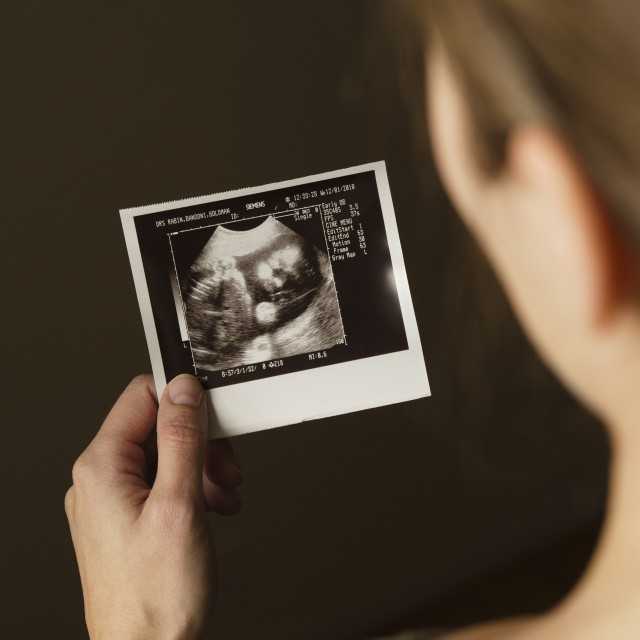 Плановое узи обследование в 21-22 недели беременности