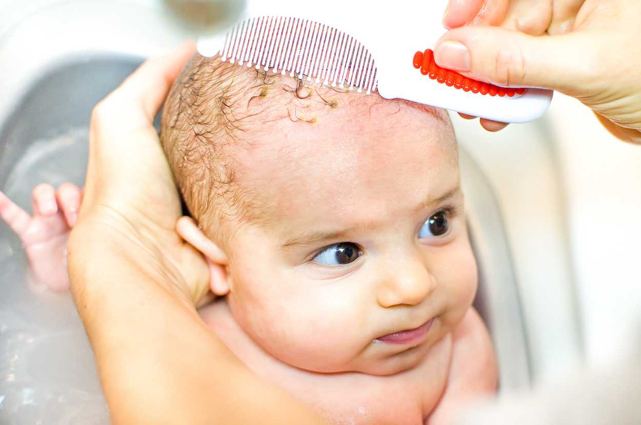 Как убрать корочки на голове у ребенка – пошаговая инструкция для мам