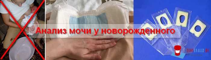 Как правильно собрать анализ мочи у грудничка?