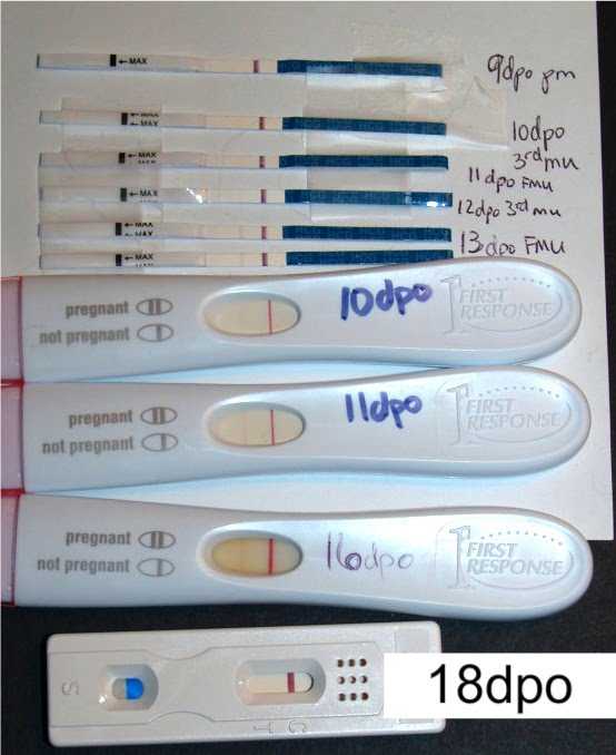Как определить внематочную беременность на ранних сроках