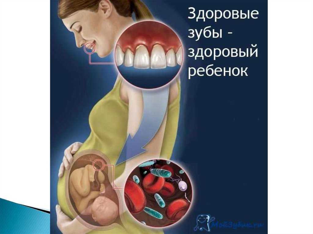 Рентген зубов при беременности: рекомендации для будущих мам