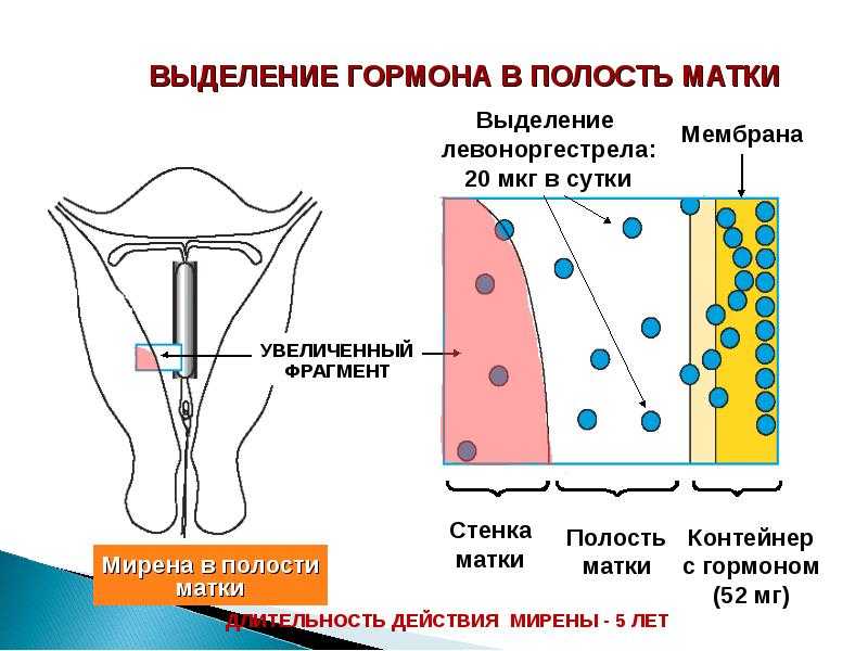 Одной из составляющих комплексной и успешной подготовки организма к родам является подготовка шейки матки к родам Какую роль шейка матки играет при родах