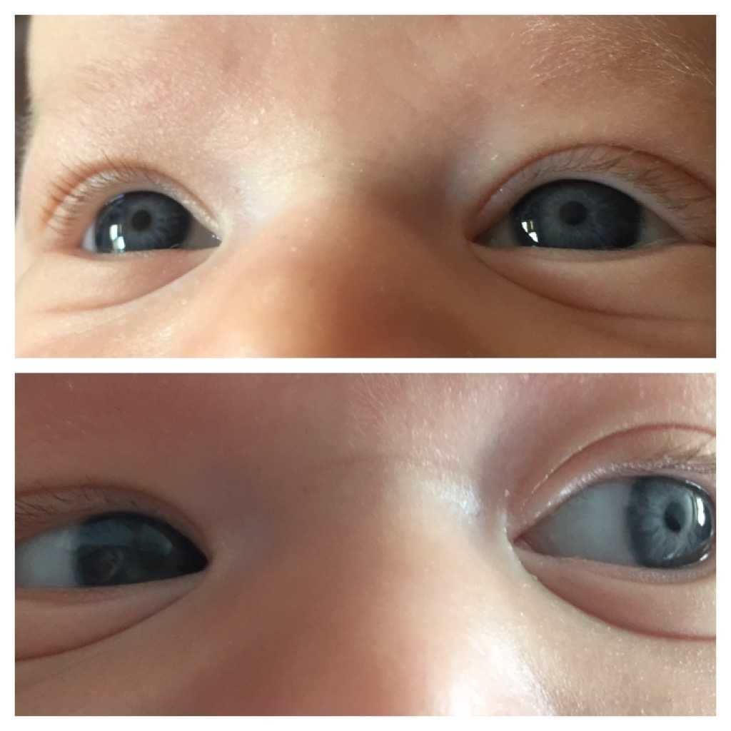 Когда меняется цвет глаз у новорожденных и почему это происходит